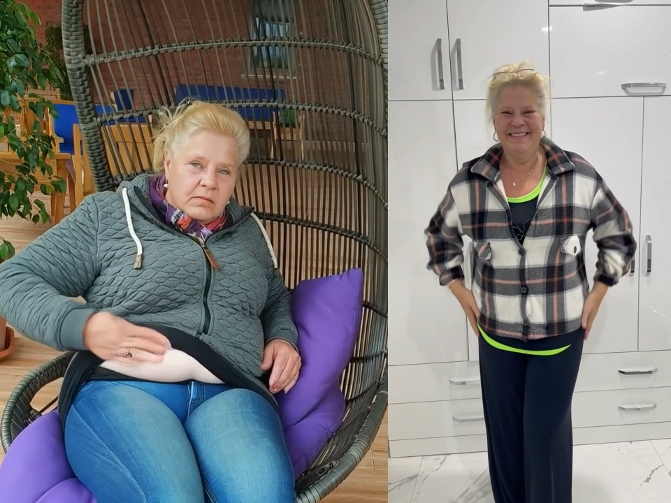 Silvia Wollny before after